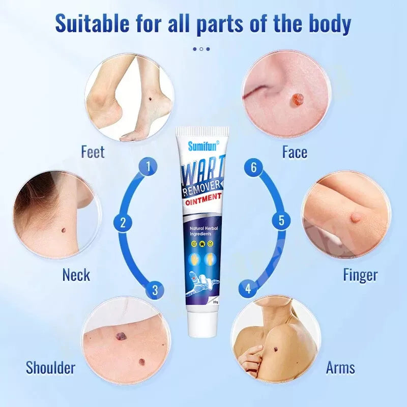 Aurece – WartClear Herbal Removal Cream Dermacure Pro