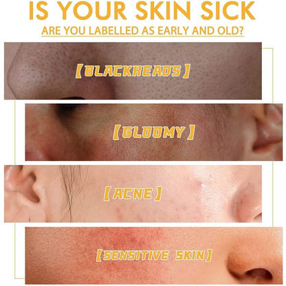 Aurece – Honey Radiance Peel-Off Mask Refiner