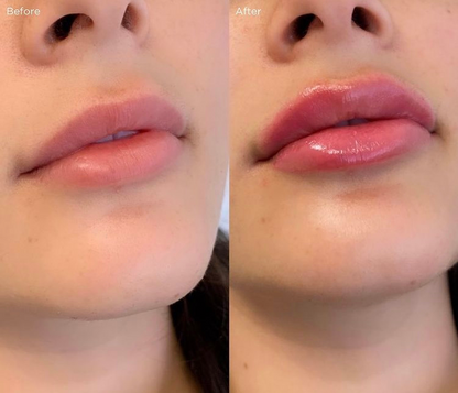 Aurece Prima Silicone Lip Plump Stick