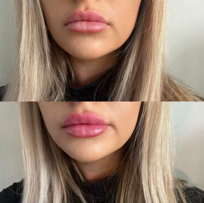 Aurece Prima Silicone Lip Plump Stick