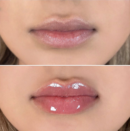 Aurece - Prima Silicone Lip Plump Stick
