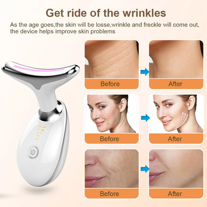 Aurece – Radiance Lift EMS Wrinkle Removal & Firming Massager Pro