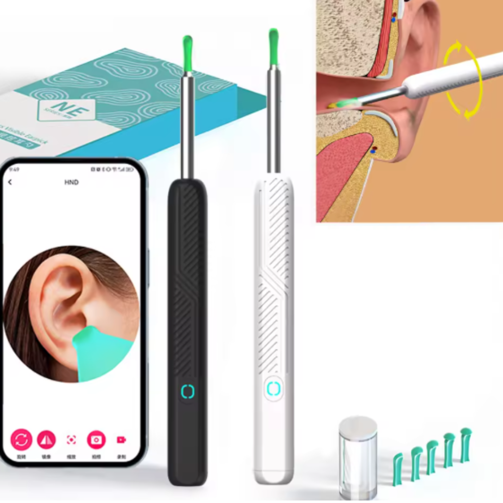 Aurece – Smart WiFi Ear Wax Removal Scope ClearView Pro