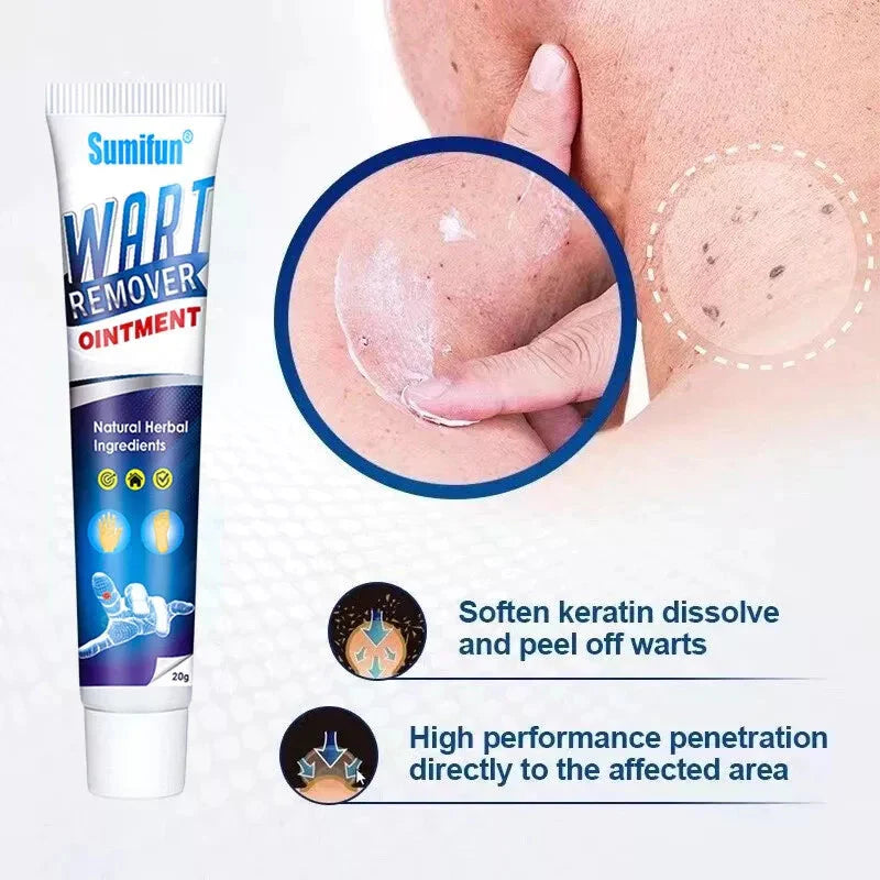 Aurece – WartClear Herbal Removal Cream Dermacure Pro