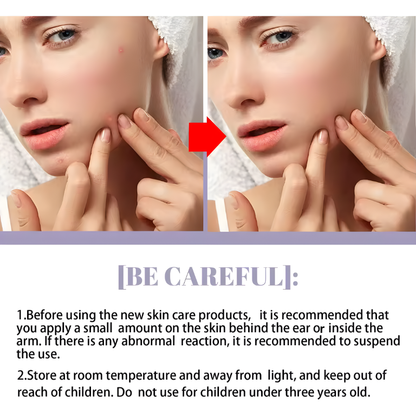 
Green Tea Eggplant Solid Mask Deep Cleansing Oil Control Balance Antioxidan Shrink Pores Remove Blackheads Refreshing Mud Mask