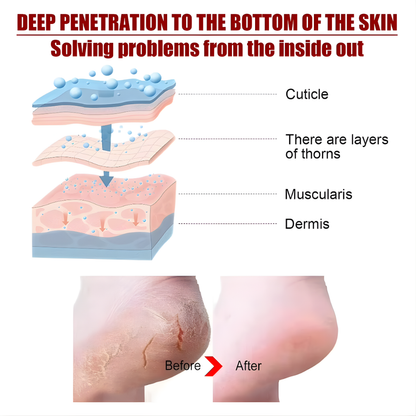 Natural Detox Foot Patches Stress Relief Feet Deep Sleep Herbal Detox Sticker Relieve Stress For Foot Care Tools