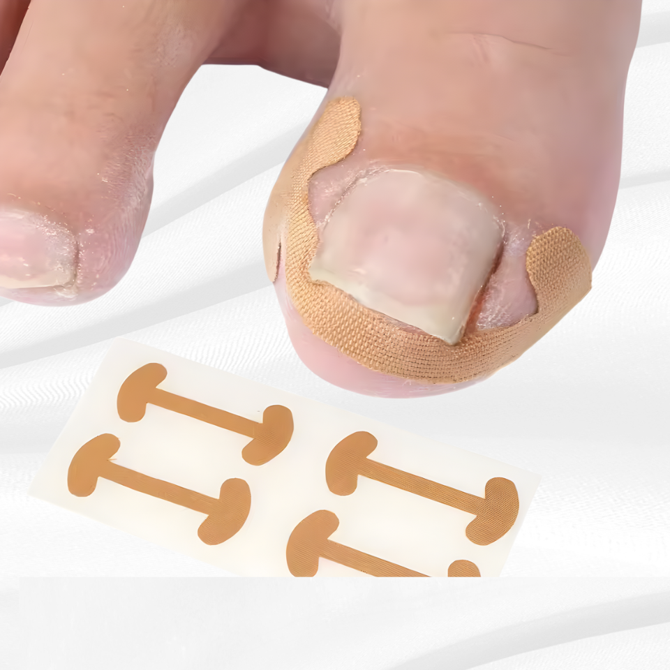 Professional Ingrown Toenail Foot Corrector Stickers Elasticity Toe Nail Care Pedicure Tools Health Care Protects Toe Nail