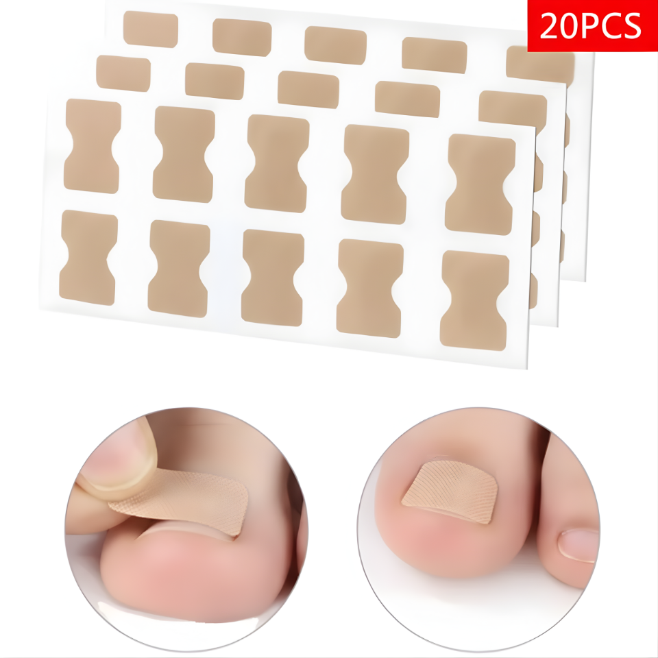 IngrowRescue™ Elastic Tabs