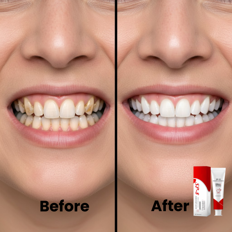 Sp-8 Probiotic Whitening Toothpaste Freshens Breath, Improves Gum Health, Reduces Tartar Teeth Whitening Agent